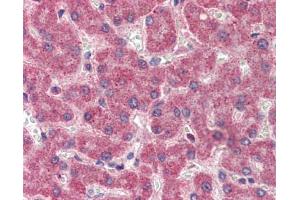 Immunohistochemistry (IHC) image for anti-Coagulation Factor II (thrombin) (F2) (Middle Region) antibody (ABIN2776976) (Prothrombin 抗体  (Middle Region))