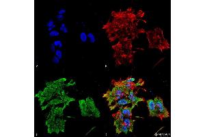 Immunocytochemistry/Immunofluorescence analysis using Mouse Anti-Alpha B Crystallin Monoclonal Antibody, Clone 3A10.