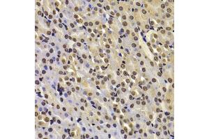 Immunohistochemistry of paraffin-embedded mouse kidney using FBXW7 antibody (ABIN6131632, ABIN6140535, ABIN6140537 and ABIN6221574) at dilution of 1:100 (40x lens). (FBXW7 抗体  (AA 408-707))