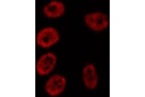 ABIN6276885 staining HepG2? (GADD45A 抗体  (N-Term))