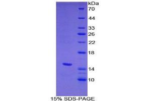 SDS-PAGE of Protein Standard from the Kit  (Highly purified E. (HPSE ELISA 试剂盒)