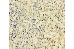 Immunohistochemistry of paraffin-embedded human spleen tissue using ABIN7147970 at dilution of 1:100 (IREM1 抗体  (AA 20-156))