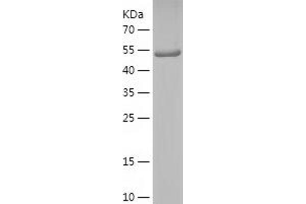 CLEC11A Protein (AA 22-293) (His-IF2DI Tag)