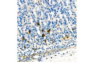Immunohistochemistry of paraffin embedded rat stomach using ghrelin (ABIN7074040) at dilution of 1:1500 (400x lens) (Ghrelin 抗体)