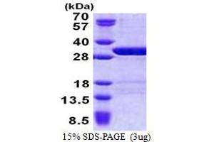 SDS-PAGE (SDS) image for Ubiquitin Specific Peptidase 15 (USP15) (AA 1-235) protein (His tag) (ABIN7280375)