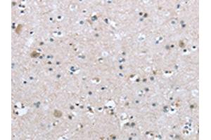 The image on the left is immunohistochemistry of paraffin-embedded Human brain tissue using ABIN7192921(TRPM3 Antibody) at dilution 1/20, on the right is treated with synthetic peptide. (TRPM3 抗体)