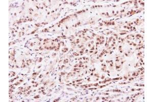 IHC-P Image Immunohistochemical analysis of paraffin-embedded A549 xenograft, using PRMT2, antibody at 1:100 dilution. (PRMT2 抗体)