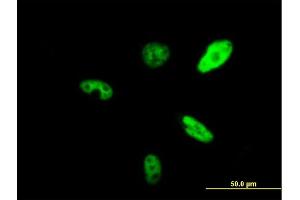 Immunofluorescence of purified MaxPab antibody to SMARCAD1 on HeLa cell. (SMARCAD1 抗体  (AA 1-1028))