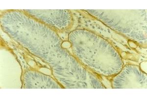Image no. 1 for anti-Collagen, Type IV (COL4) antibody (ABIN335405) (Collagen IV 抗体)