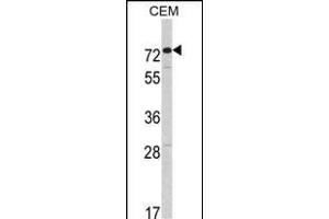Western blot analysis of HR2 Antibody (C-term) (ABIN391175 and ABIN2841275) in CEM cell line lysates (35 μg/lane).