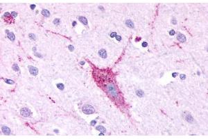 Anti-GPR61 antibody  ABIN1048847 IHC staining of human brain, neurons and glia. (GPR61 抗体  (C-Term))