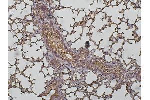 Immunoperoxidase of polyclonal antibody to CTSD (1:200) on paraformaldehyde-fixed paraffin-embedded lung,