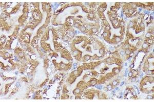 Immunohistochemistry of paraffin-embedded Mouse kidney using DLAT Polyclonal Antibody at dilution of 1:100 (40x lens). (DLAT 抗体)