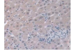 IHC-P analysis of Human Liver Tissue, with DAB staining. (ORM1 抗体  (AA 19-201))