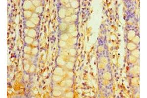 Immunohistochemistry of paraffin-embedded human colon tissue using ABIN7163238 at dilution of 1:100 (PIGX 抗体  (AA 42-230))