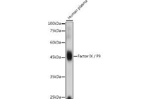 Western blot analysis of extracts of Human plasma, using Factor IX / F9 antibody (ABIN3022173, ABIN3022174, ABIN3022175, ABIN1512886 and ABIN6218646) at 1:1000 dilution. (Coagulation Factor IX 抗体  (AA 29-192))