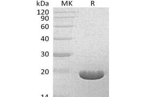 Western Blotting (WB) image for Bifunctional Apoptosis Regulator (BFAR) protein (ABIN7321012) (BFAR 蛋白)