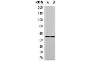 Western blot analysis of RUNX1 expression in Jurkat (A), THP1 (B) whole cell lysates. (RUNX1 抗体)