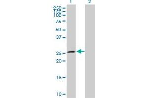 Western Blot analysis of XRCC6BP1 expression in transfected 293T cell line by XRCC6BP1 MaxPab polyclonal antibody. (XRCC6BP1 抗体  (AA 1-246))