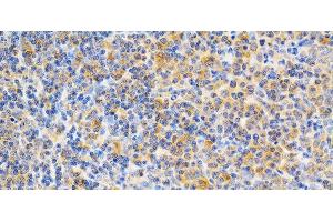 Immunohistochemistry of paraffin-embedded Rat spleen using PRKCE Polyclonal Antibody at dilution of 1:200 (40x lens). (PKC epsilon 抗体)