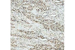 IHC analysis of KAT1/HAT1 using anti-KAT1/HAT1 antibody (ABIN7603224).