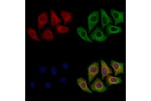 ABIN7094866 and ABIN7098918 staining Hela cells by IF/ICC. (SPRED2 抗体  (Internal Region))