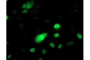 Anti-PHF21B mouse monoclonal antibody (ABIN2454829) immunofluorescent staining of COS7 cells transiently transfected by pCMV6-ENTRY PHF21B (RC204284). (PHF21B 抗体)