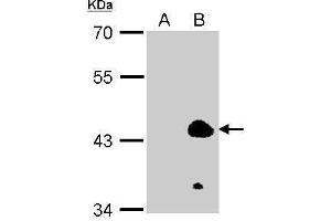 WB Image Sample (100ug of whole cell lysate) A: 293T (mock) B: 293T transfected KLF1 antibody diluted at 1:2000 (KLF1 抗体  (N-Term))
