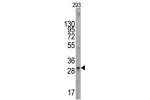 Image no. 1 for anti-KIT Ligand (KITLG) (C-Term) antibody (ABIN357009) (KIT Ligand 抗体  (C-Term))