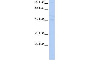 WB Suggested Anti-SGK3 Antibody Titration: 0. (SGK3 抗体  (N-Term))