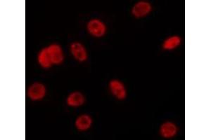 ABIN6275687 staining Hela by IF/ICC. (ZC3H13 抗体  (C-Term))
