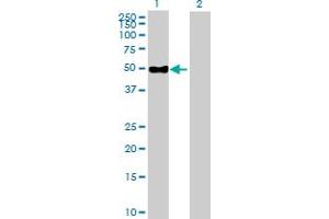 Western Blot analysis of ENPP6 expression in transfected 293T cell line by ENPP6 MaxPab polyclonal antibody. (ENPP6 抗体  (AA 1-440))