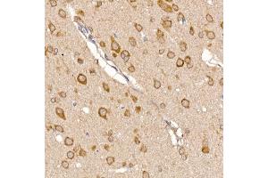 Immunohistochemistry (IHC) image for anti-Thioredoxin Domain Containing 12 (Endoplasmic Reticulum) (TXNDC12) antibody (ABIN7270799)