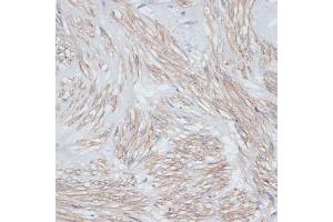 Immunohistochemistry of paraffin-embedded human uterus using Tropomyosin 1 antibody (ABIN3021577, ABIN3021578, ABIN3021579, ABIN1513635 and ABIN6215262) at dilution of 1:100 (40x lens). (Tropomyosin 抗体  (AA 1-245))