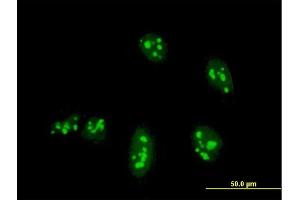 Immunofluorescence of monoclonal antibody to NANOG on HeLa cell. (Nanog 抗体  (AA 98-195))