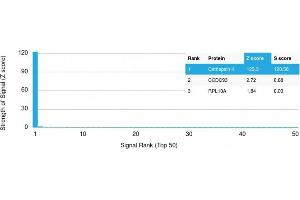 Analysis of Protein Array containing more than 19,000 full-length human proteins using Cathepsin K Mouse Monoclonal Antibody (CTSK/2791) Z- and S- Score: The Z-score represents the strength of a signal that a monoclonal antibody (MAb) (in combination with a fluorescently-tagged anti-IgG secondary antibody) produces when binding to a particular protein on the HuProtTM array. (Cathepsin K 抗体  (AA 163-274))