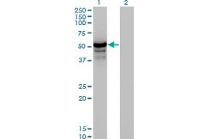 Western Blotting (WB) image for anti-Homocysteine-Inducible, Endoplasmic Reticulum Stress-Inducible, Ubiquitin-Like Domain Member 1 (HERPUD1) (AA 74-180) antibody (ABIN564201)