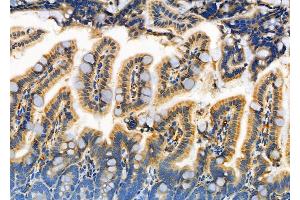 ABIN6261519 and ABIN6266943 at 1/100 staining Mouse colorectal tissue by IHC-P. (ELOVL1 抗体  (Internal Region))