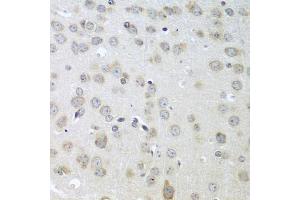 Immunohistochemistry of paraffin-embedded mouse brain using ACHE antibody (ABIN5974721) at dilution of 1/100 (40x lens). (Acetylcholinesterase 抗体)