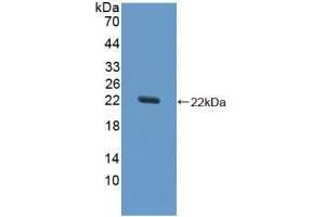 Western Blotting (WB) image for anti-Superoxide Dismutase 1, Soluble (SOD1) (AA 2-154) antibody (ABIN2913314)