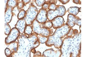 Immunohistochemistry (IHC) image for anti-V-type immunoglobulin domain-containing suppressor of T-cell activation (VISTA) antibody (ABIN6940575)