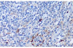 Immunohistochemistry of paraffin-embedded Human tonsil using PADI4 Polyclonal Antibody at dilution of 1:100 (40x lens).