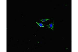 Immunofluorescent analysis of SH-SY5Y cells using ABIN7161278 at dilution of 1:100 and Alexa Fluor 488-congugated AffiniPure Goat Anti-Rabbit IgG(H+L) (NEFL 抗体  (AA 128-271))