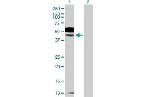 Western Blot analysis of IL1R2 expression in transfected 293T cell line by IL1R2 MaxPab polyclonal antibody. (IL1R2 抗体  (AA 1-398))