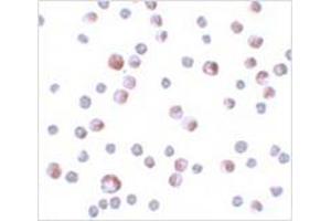 Immunocytochemistry of TCTN3 in HeLa cells with TCTN3 antibody at 4 μg/ml. (TCTN3 抗体  (C-Term))