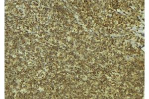 ABIN6279569 at 1/100 staining Mouse pancreas tissue by IHC-P. (ESCO1 抗体  (Internal Region))