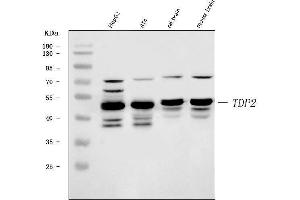 Western blot analysis of TDP2 using anti-TDP2 antibody (ABIN7600905). (TDP2 抗体  (AA 25-332))