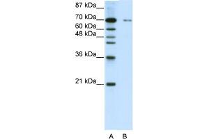 WB Suggested Anti-ZNF398 Antibody Titration:  0. (ZNF398 抗体  (C-Term))
