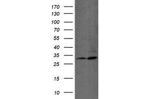 Western Blotting (WB) image for anti-Proteasome (Prosome, Macropain) Subunit, beta Type, 7 (PSMB7) (AA 58-277) antibody (ABIN1491599) (PSMB7 抗体  (AA 58-277))