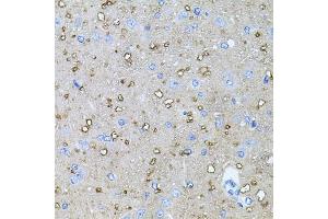 Immunohistochemistry (IHC) image for anti-Neurotrophin 4 (NTF4) (AA 25-210) antibody (ABIN3021388)